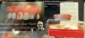 Teeth on Display at National Museum